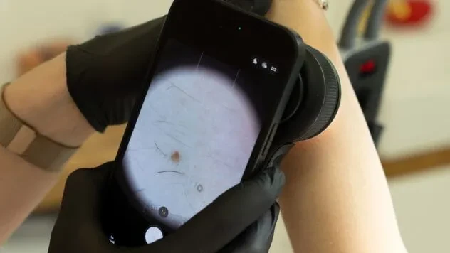 Нова родимка чи звичайний висип: коли шкіра насправді просить про допомогу